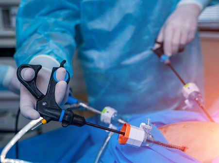 General Surgery